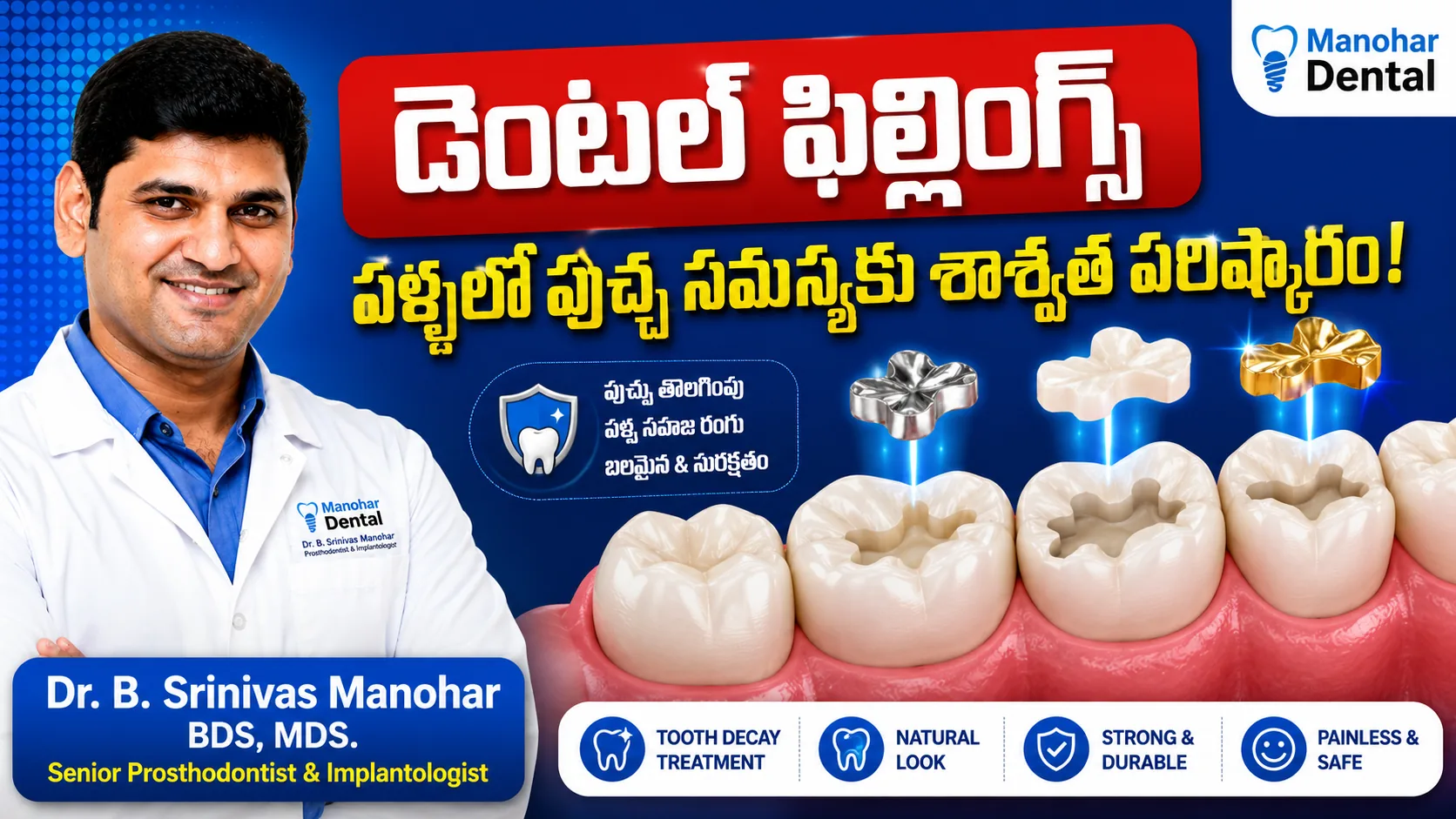 Dental Fillings video thumbnail